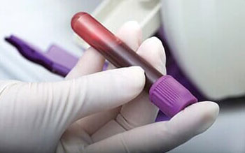 análisis de drogas en sangre para el empleo