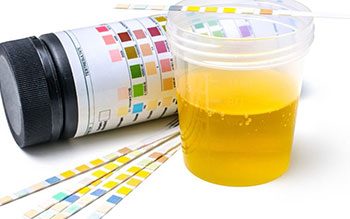 drug testing in urine