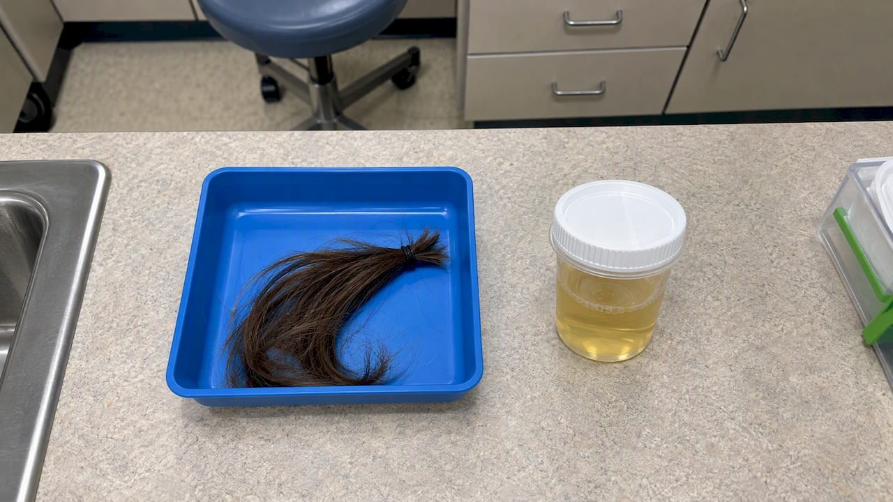 1791809013952_Hair-and-urine-samples-side-by-side